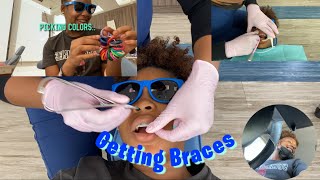 BRACES VLOG  Come w me to get braces [upl. by Aiuqenehs]