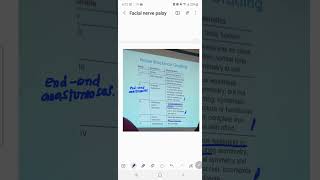 HOUSE BRACKMAN GRADING OF FACIAL PARALYSIS [upl. by Juetta]