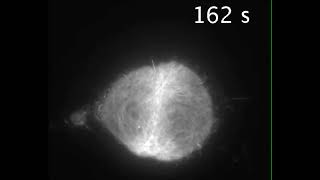 Cytokinesis in vertebrate cells initiates by contraction of an equatorial actomyosin network [upl. by Orravan405]