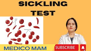 SICKLING TESTSICKLIE CELL ANEMIAExplained in Hindi 👍👍 [upl. by Tenom167]