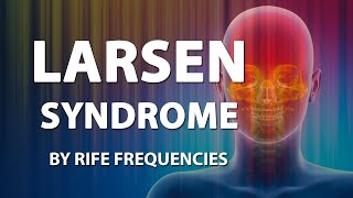 Larsen Syndrome  RIFE Frequencies Treatment  Online Sound Therapy  Positive Energy Healing [upl. by Yreme]