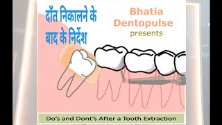 Post tooth Extraction  दाँत निकलवाने के बाद ध्यान देने वाले कुछ निर्देश  By Dr Praveen Bhatia [upl. by Lamori713]