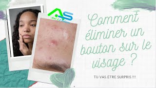 Beauté  comment éliminer rapidement un bouton sur le visage [upl. by Kred512]