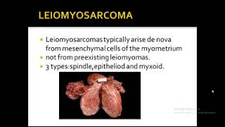 Abnormal Uterine Bleeding Causes  Leiomyoma and Fibroids [upl. by Farnham812]