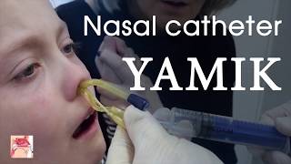 Nasal catheter YAMIK New drug delivery sistems for topical treatment for sinusitis [upl. by Nirmak]