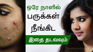 How to remove pimple  Home remedies for pimples  Beauty Tips in Tamil [upl. by Eeluj]