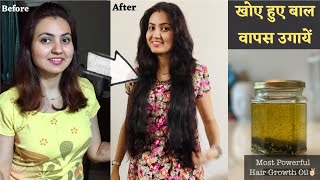 सबसे Powerful Hair Growth Oil to REGROW LOST HAIR  खोये हुए बालों को वापस उगाने सबसे अचूक तरीका [upl. by Lothair]