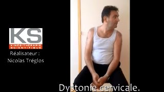 Dystonie cervicale torticolis rotatoire gauche [upl. by Norda]