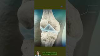 Sport injuries\ in the largest and strongest Joint knee  knee joint [upl. by Inttirb]