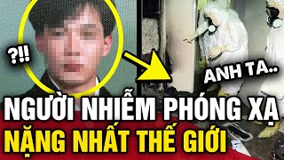 Chàng trai người Nhật NHIỄM PHÓNG XẠ nặng nhất thế giới và 83 ngày ĐỊA NGỤC  Tin 3 Phút [upl. by Eirtemed565]