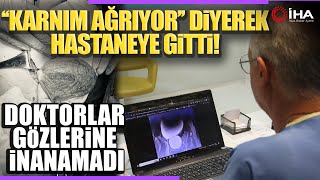 12 Yaşındaki Genç Kızın Karnından Kavun Büyüklüğünde Kitle Çıktı [upl. by Nayarb977]