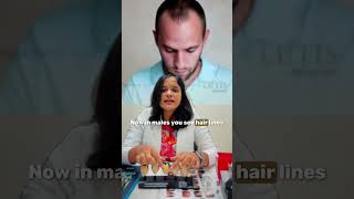 Genetic Hair Loss Key Signs and When to See a Dermatologist  Hair Care Tips [upl. by Eerahs796]