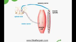 Myofascial Trigger Points Causes and Treatment [upl. by Ymor]