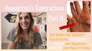 Dupuytrens Part II Easy Stretches YOU CAN DO [upl. by Jessamyn]