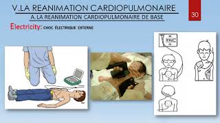 Arrêt cardiorespiratoire du nourrisson et de l’enfant en anesthésie [upl. by Arnst958]