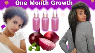 Onion Juice For Hair Growth 😱BEFORE AND AFTER RESULTS [upl. by Nnylaj]