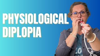 Physiological Diplopia Explanation and Treatment  Advanced Vision Therapy [upl. by Katine]