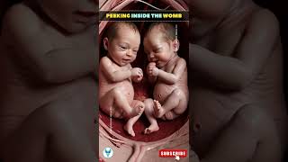 Inside mothers womb ❤️ A Small Glimpse at your Babys growth shortsfeed baby Love [upl. by Aed]