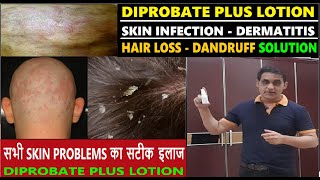 Diprobate Plus Lotion To Treat Dermatitis Dandruff amp All Skin Problems  Improve Hair Growth [upl. by Pubilis]