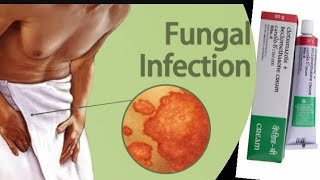 𝗙𝗨𝗡𝗚𝗔𝗟 𝗜𝗡𝗙𝗘𝗖𝗧𝗜𝗢𝗡fungalinfectionsathletesfootringwormtreatmentpsoriasisitchingproblemcandidb 💊 [upl. by Crawford]