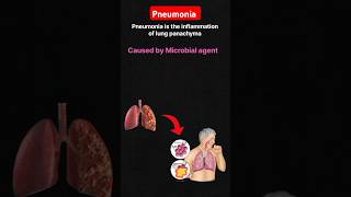 What is the pneumonia  Pneumonia etiology symptoms disease Lungsdisease [upl. by Aja959]