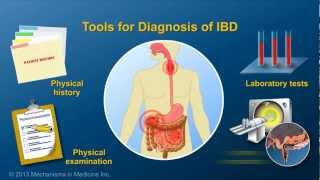 Diagnosing IBD [upl. by Wiener163]