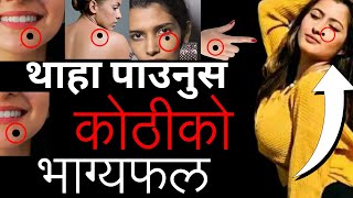 यो ठाउमा कोठी हुनुको फाईदै फाईदा Advantages of having Small moles in body [upl. by Luanni]