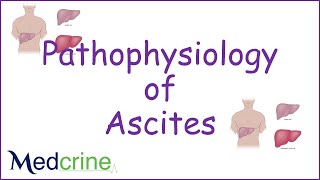 pathophysiology of ascites [upl. by Lusar]