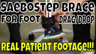 SaeboStep Brace for Foot DragDrop  REAL Patient Footage [upl. by Ott]