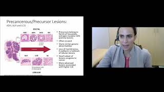 Breast Pathology Why Do Some Lesions Require Surgery and Others Do Not [upl. by Julide]