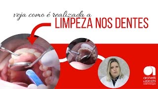 Higiene bucal veja como é realizada a limpeza dental profilaxia [upl. by Nemrac]