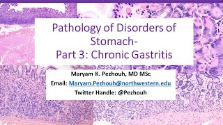 Part 3 Pathology of Gastric Disorders Chronic Gastritis [upl. by Fons]