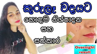 How to remove pimple acne overnightඑක් රැයකින් pimples නැති කරන හොඳම නිශ්පාදන සහ ස්වාභාවික සත්කාර [upl. by Stuart]