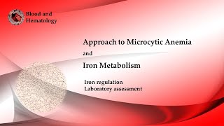 Approach To Microcytic Anemia [upl. by Melvina903]