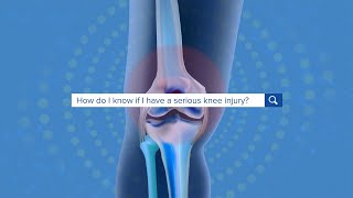 Anatomy of the knee joint [upl. by Naniac464]