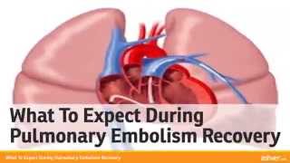 What To Expect During Pulmonary Embolism Recovery [upl. by Srini]