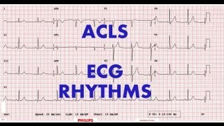 ACLS  ECG rhythm recognition amp management Part 1 [upl. by Erl]