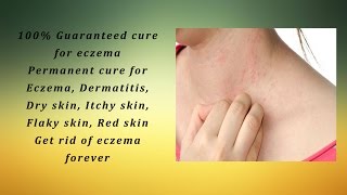 Permanent cure for Eczema Dermatitis Dry skin Itchy skin Flaky skin Red skin [upl. by Sunev]