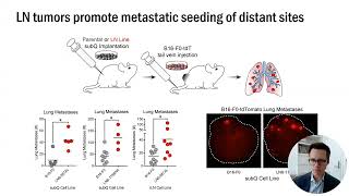 Roles of systemic immunity in tumor metastasis and effective immunotherapy [upl. by Anohs]