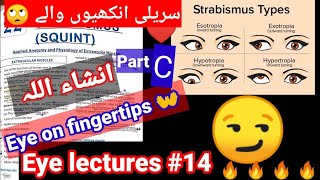 Eye lectures 14 part C  Strabismus Squient exotropia entropia hypertropia hypotropia eye [upl. by Kcirtap]