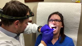 Canker Sore Treatment by Dermatologist Dr David Myers [upl. by Aikmat]