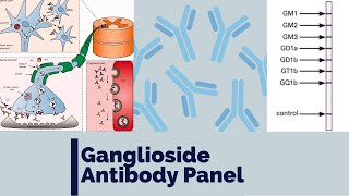 Ganglioside antibody panel  Anti GM1  Immune mediated neuropathy  MMN  MADSAM  CIDP  GBS [upl. by Nalyac]