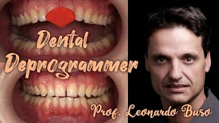 Determination of central occlusion centric relation  Deppogrammer Prof Leonardo Buso [upl. by Ahron]