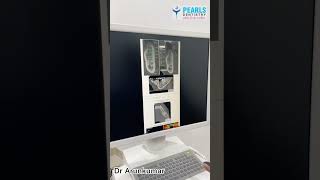 Why CBCT scan is Important for Dental Implant Planning  Dr Arunkumar  Pearls Dentistry [upl. by Deeraf]