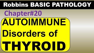 Ch20  Autoimmune Thyroid Pathology  Graves Disease  Hashimoto Robbins Pathology [upl. by Saisoj574]