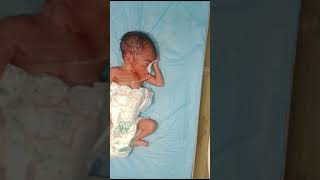 obed This newborn baby Hypotonia lack of healthy mother this newborn baby very thin body [upl. by Nonnah]