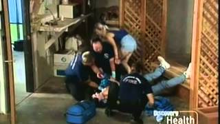 Rescue 911 Mans Wrist vs Circular Saw [upl. by Harrad]