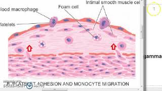 Pathology 373 c Atherosclerosis Pathogenesis [upl. by Idaf225]