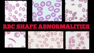 RBC Shape Abnormalities In Peripheral 🩸Blood Smear  Made Easy  Images [upl. by Forbes141]