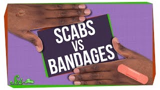 Whats Better for Wounds Scabs or Bandages [upl. by Dust]